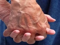 Emerald Hills Care Home