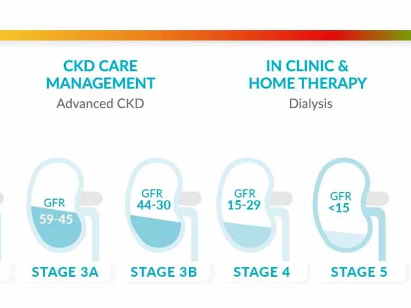 Carmen Floresville - Dialysis in Floresville, TX photo 1