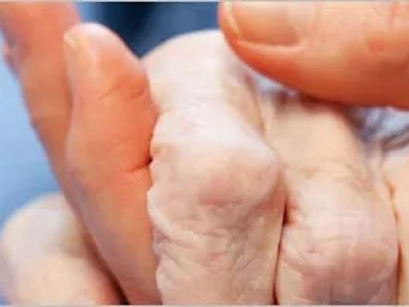 Amcare Pro Home Health - Home Health Nursing in Richardson, TX photo 2