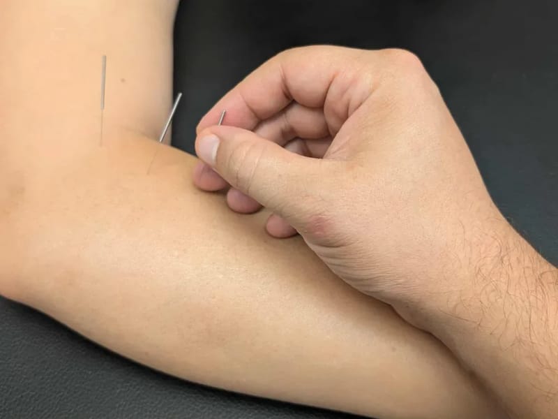 Big Easy Acupuncture & Herbal Medicine - Home Health Nursing in Metairie, LA photo 3