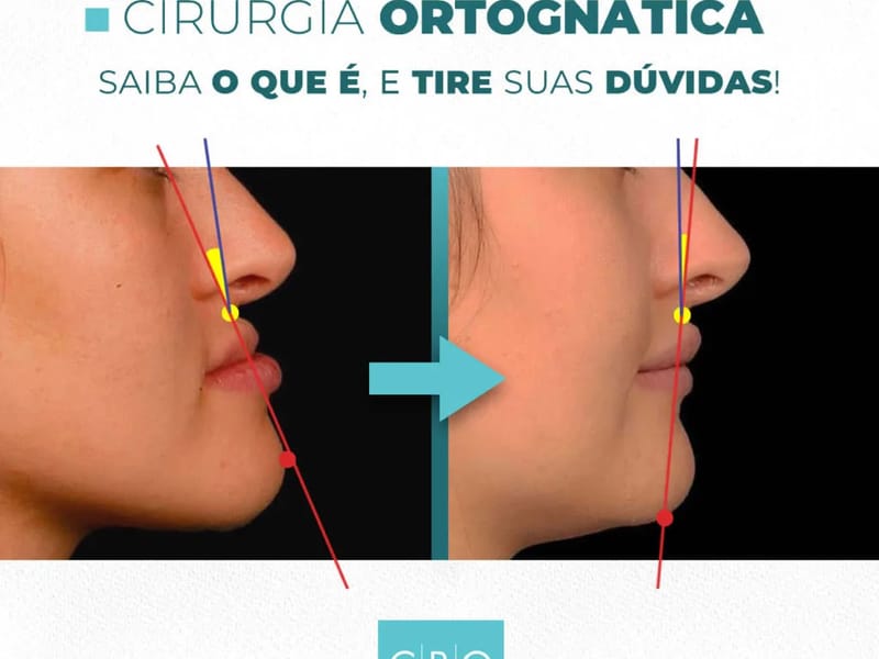 CIRURGIA DA BOCA - Cuidado Domiciliar in Umuarama, PR photo 1