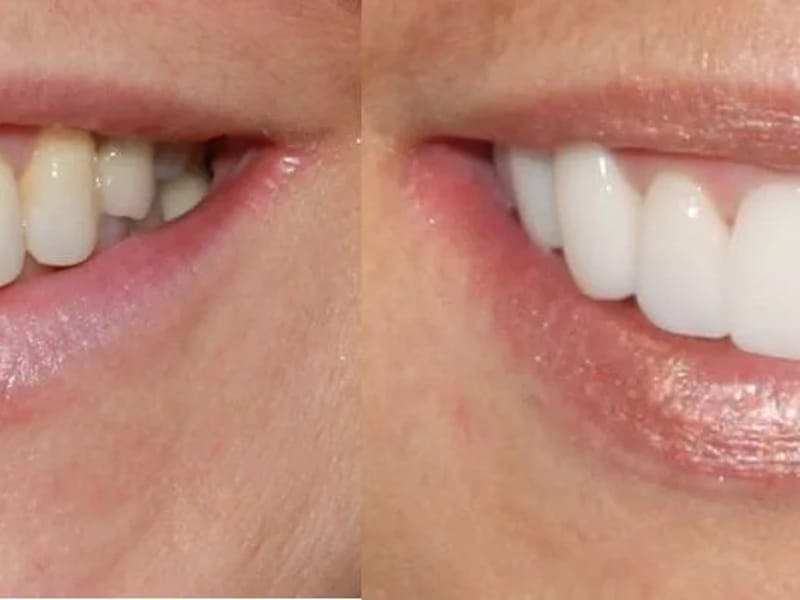 Odontologia E Estetica Dente Novo - Cuidado Domiciliar in Brasília, DF photo 3