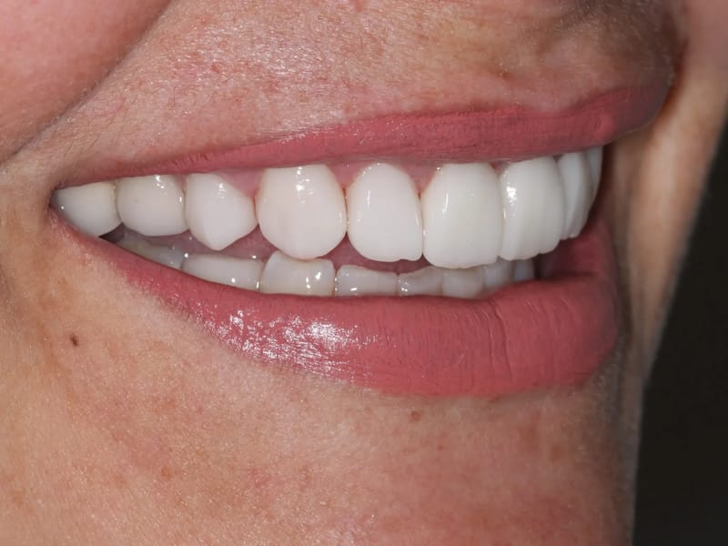 Odontologia E Estetica Dente Novo - Cuidado Domiciliar in Brasília, DF photo 2
