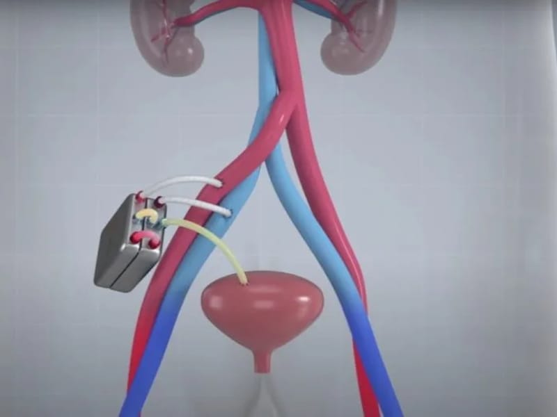 Apopka Artificial Kidney Center - Dialysis in Apopka, FL photo 2